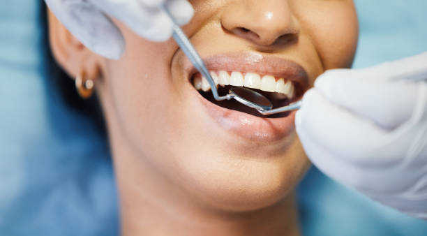 Best Chipped Tooth Repair Near Me  in Fox Chase, PA