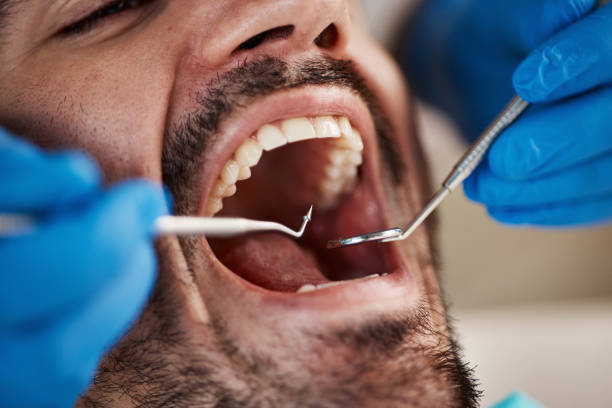 Best Dentist for Tooth Abscess  in Fox Chase, PA