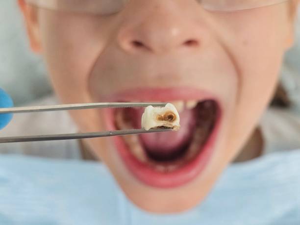 Best Tooth Pain Emergency Relief  in Fox Chase, PA